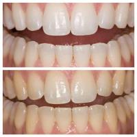 Orangevale Dental Group image 2